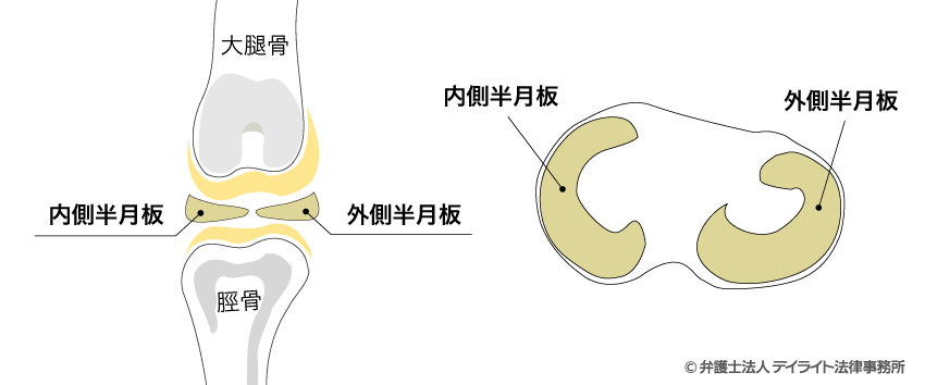 半月板のイメージ図