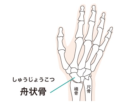 舟状骨骨折の後遺障害は？【弁護士が解説】 | デイライト法律事務所