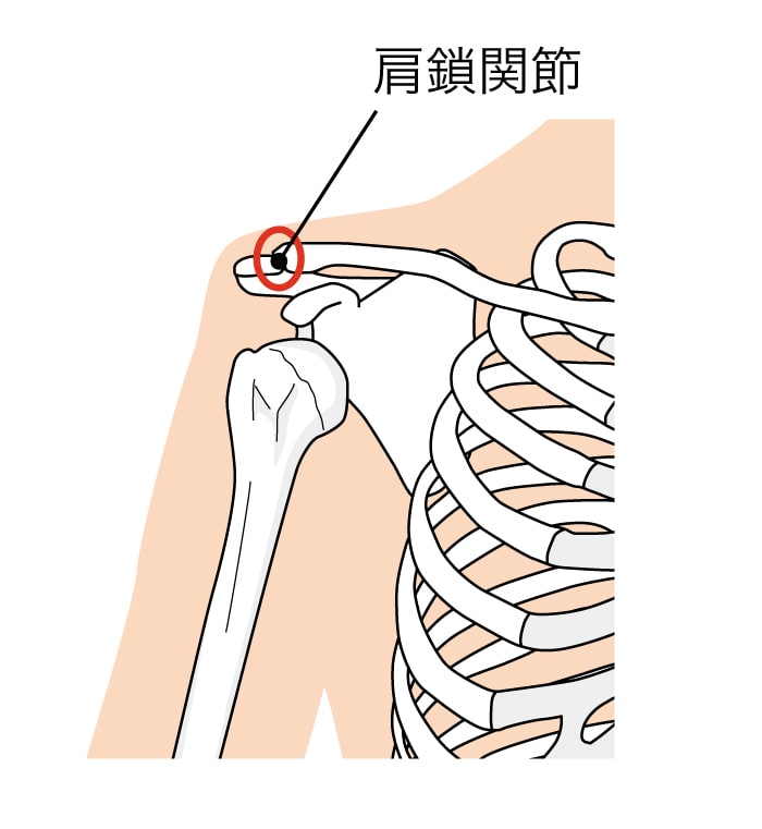 肩鎖関節脱臼