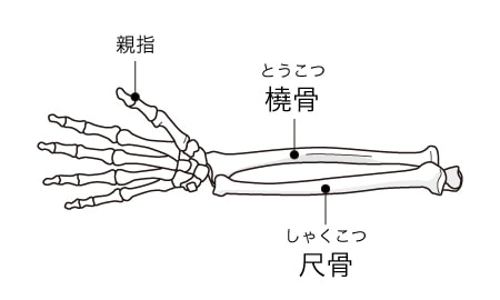 事故で橈骨遠位端骨折 ｜後遺症や慰謝料はどうなる？ | デイライト法律事務所