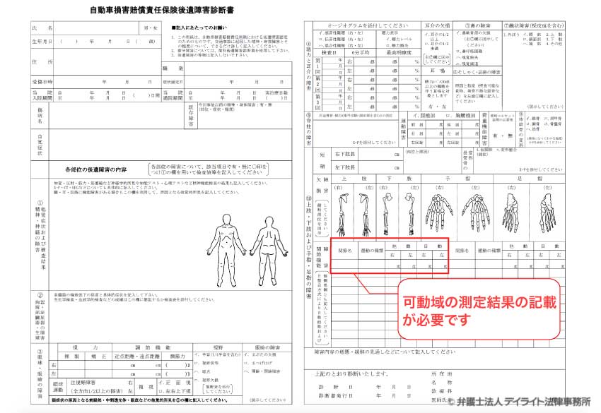 肩関節可動域制限後遺障害診断書の図