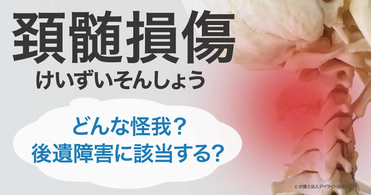 頚椎損傷後遺症 – 頚椎損傷 後遺症 残る – ZJBWUF