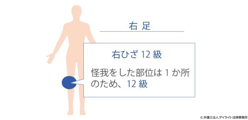 ②同じ障害のグループの等級をまとめる