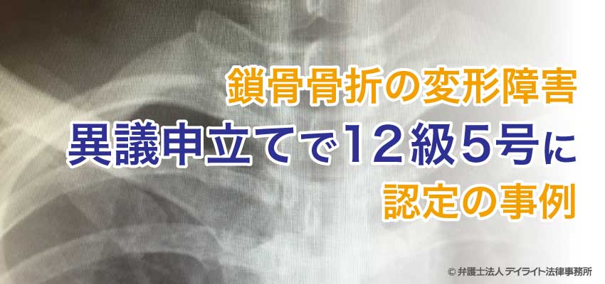 鎖骨骨折で変形障害 弁護士による異議申立てで12級5号認定の事例 デイライト法律事務所