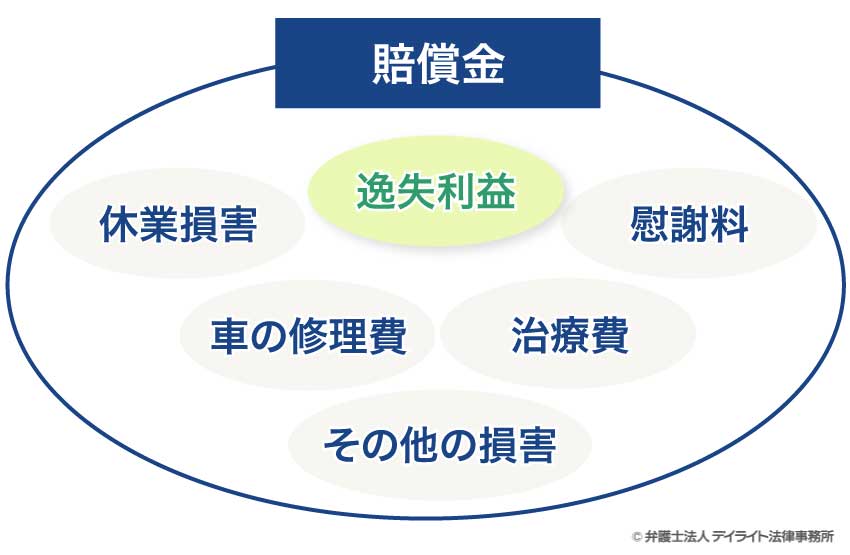 逸失利益と賠償金との関係