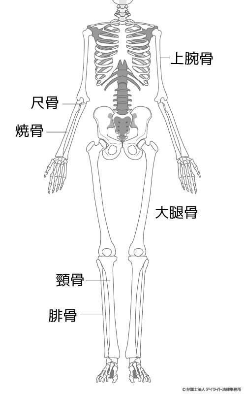 12級8号 長管骨に変形を残すもの