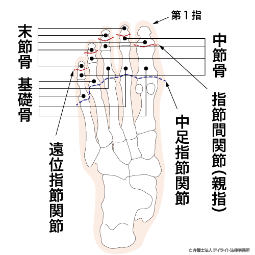 12級12号 1足の第1の足指又は他の4の足指の用を廃したもの