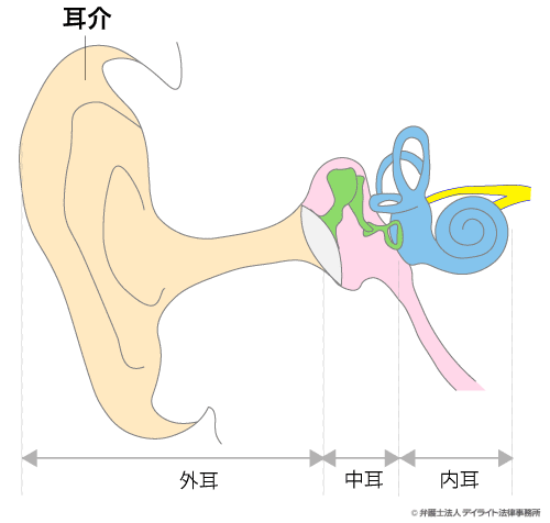 12級4号 1耳の耳殻の大部分を欠損したもの