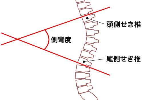 コブ法のイメージ図