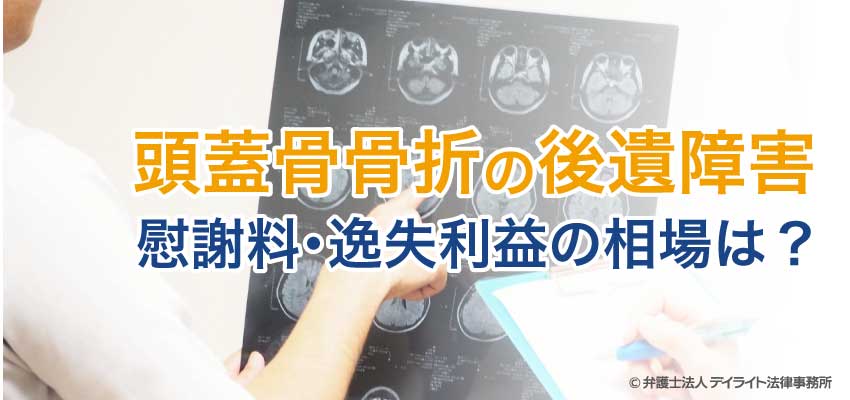 交通事故で頭蓋骨骨折 後遺障害や慰謝料 逸失利益の相場は デイライト法律事務所