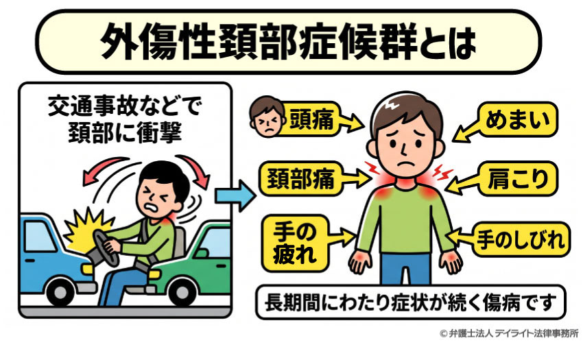 外傷性頚部症候群とは