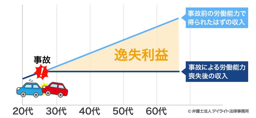 逸失利益の図