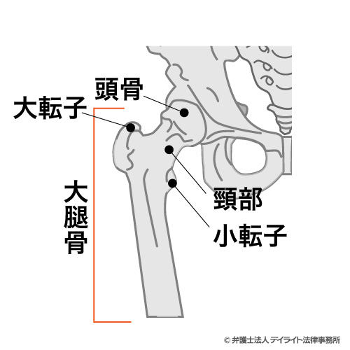 股関節のイメージ図