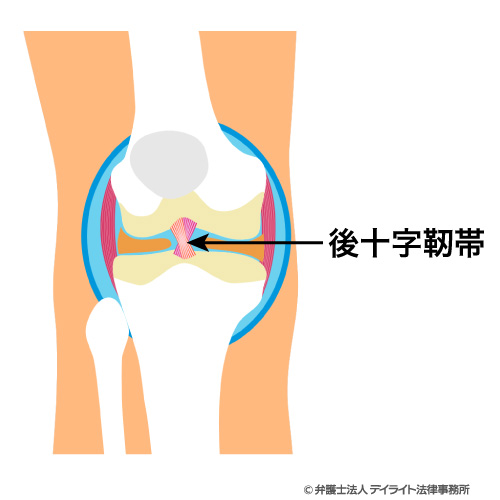 後十字靭帯のイメージ図