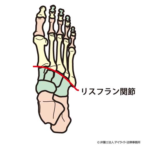リスフラン関節のイメージ