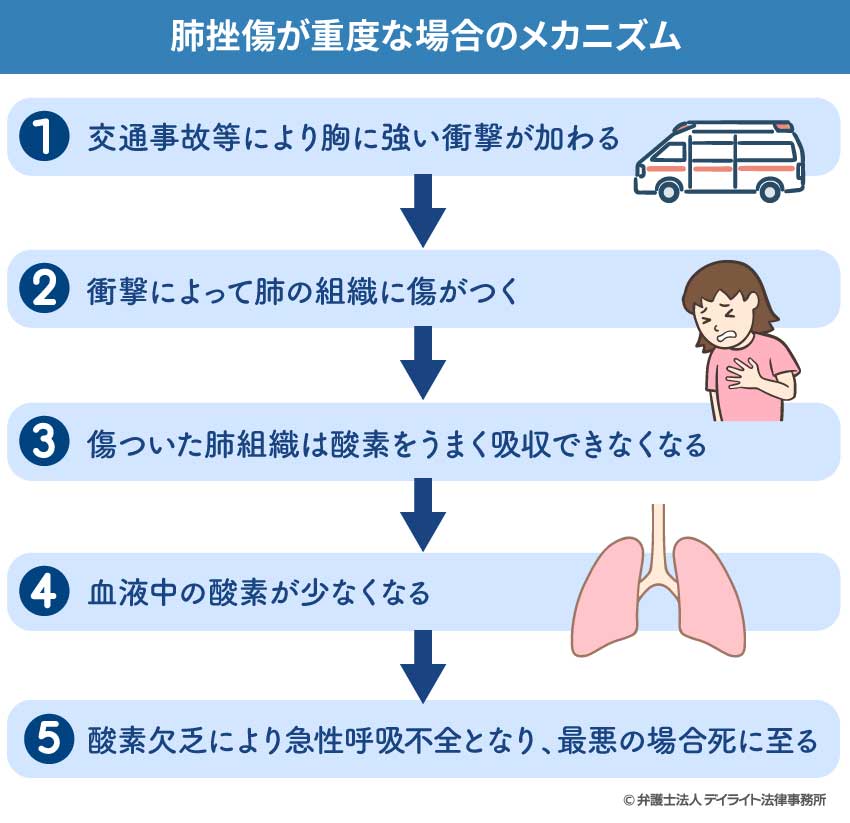 肺挫傷が重度な場合のメカニズムは