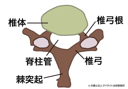 せき柱に変形を残すものとは