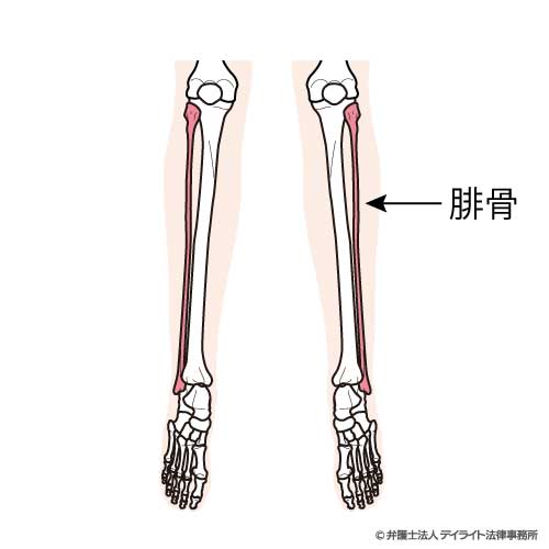 腓骨のイメージ図
