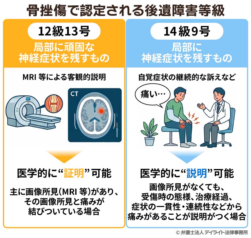 骨挫傷で認定される後遺障害等級