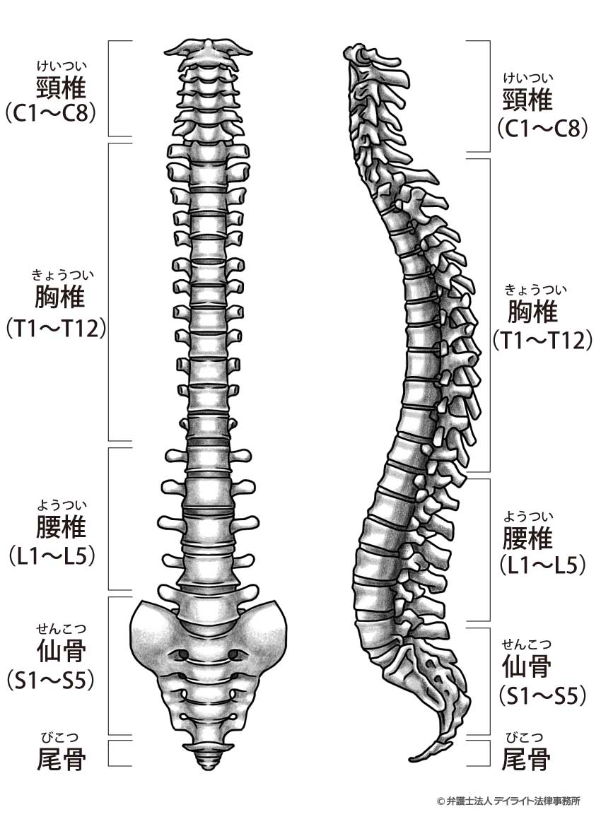 背骨骨折による後遺症のポイント｜弁護士が解説 | 交通事故の相談はデイライト法律事務所