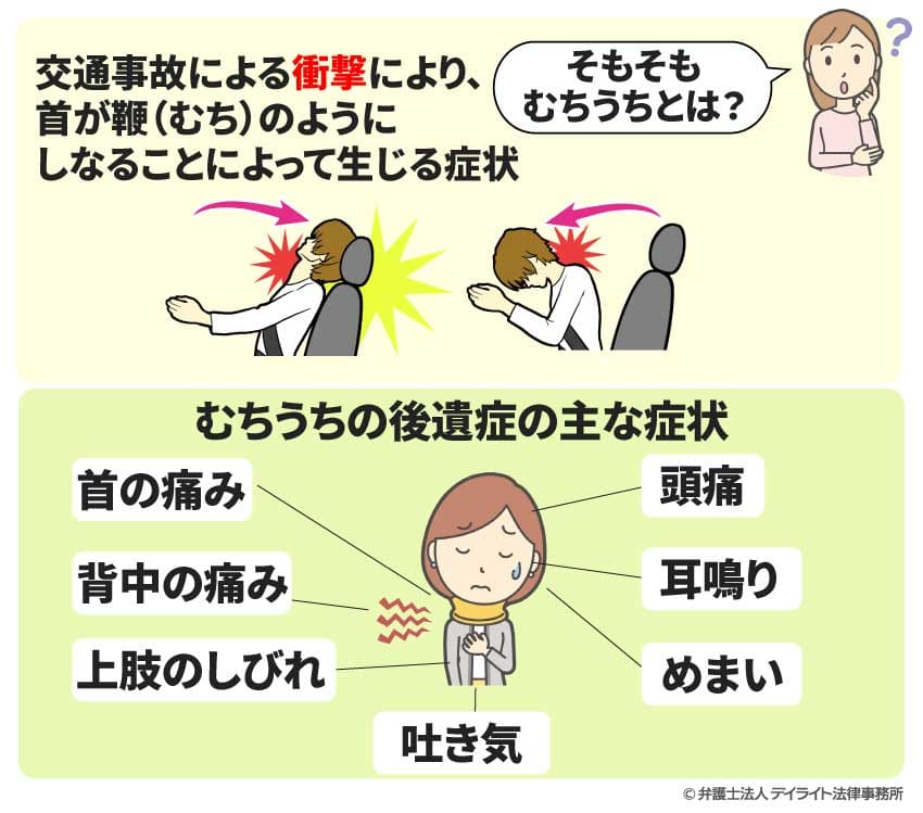 むちうちの後遺症の主な症状