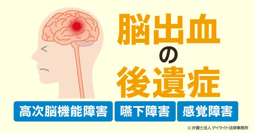 脳出血の後遺症