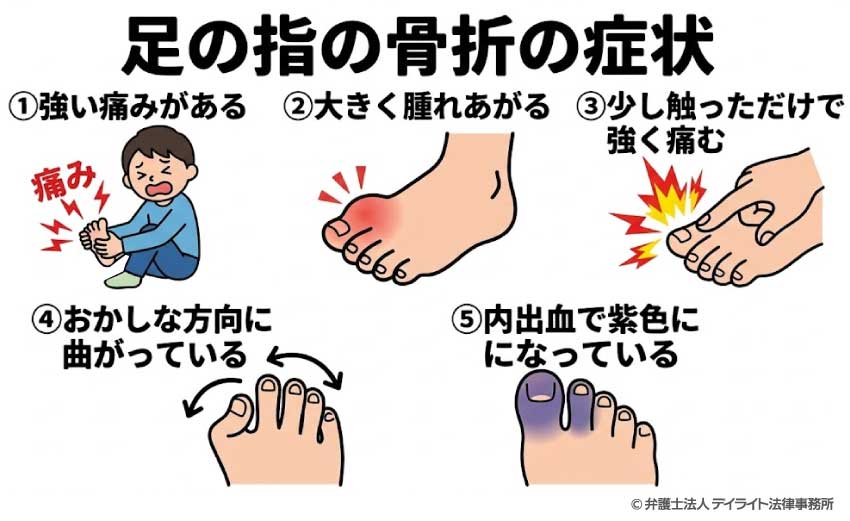 足の指の骨折|症状と見分け方
