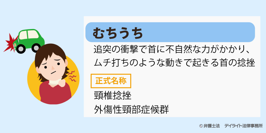 むちうちの症状