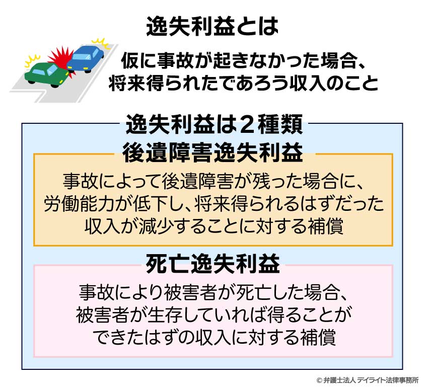 逸失利益とは