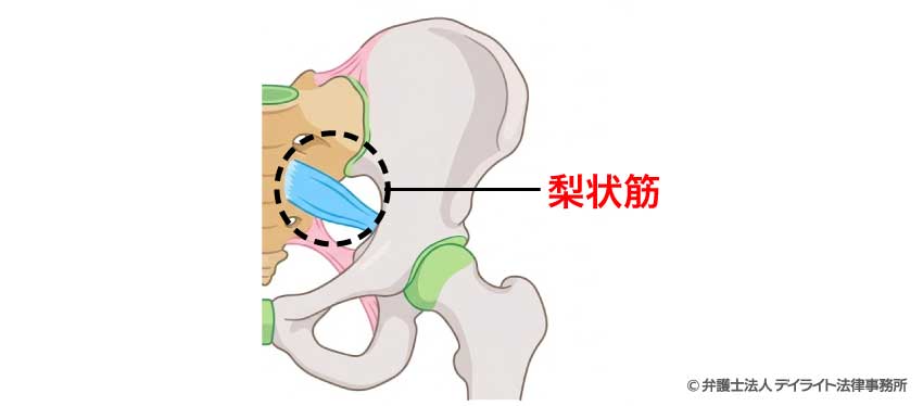 梨状筋