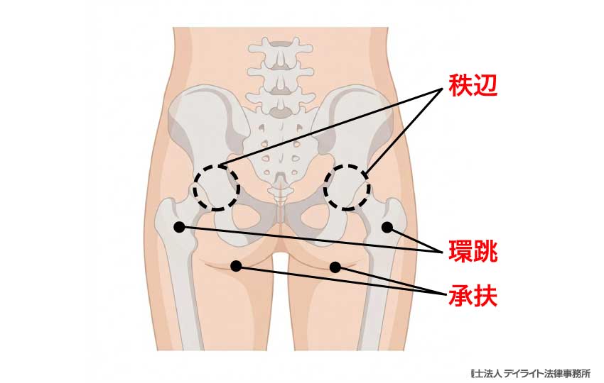 「環跳」「秩辺」「承扶」