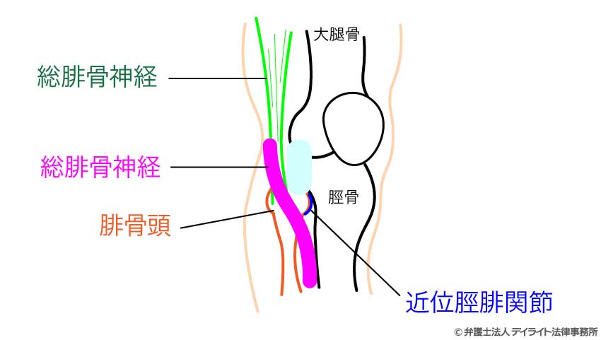 腓骨神経等のイメージ図