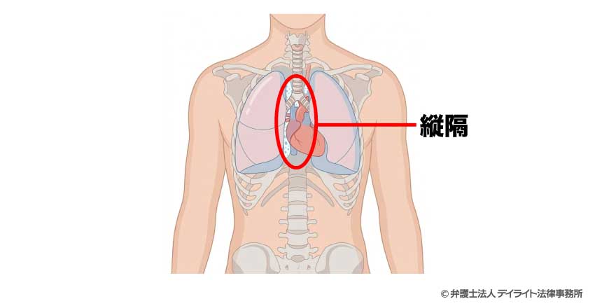 縦隔