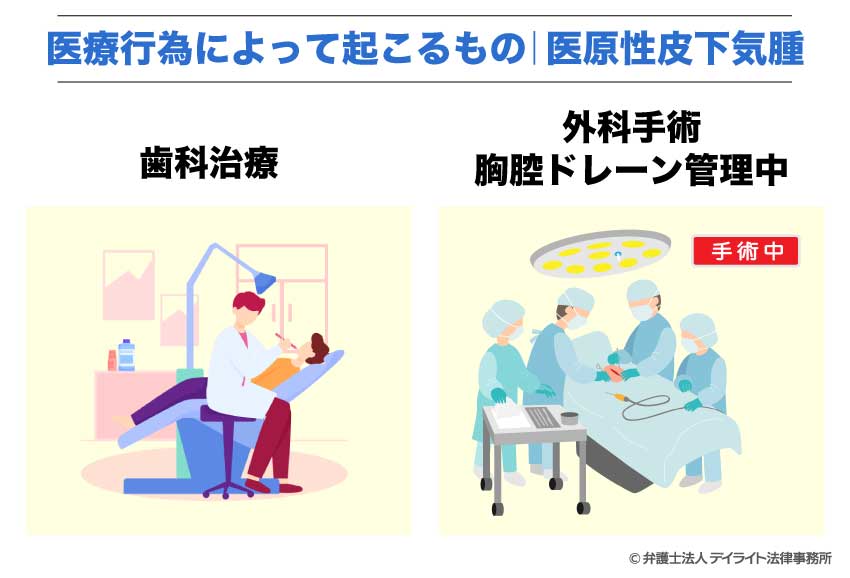 医療行為によって起こるもの｜医原性皮下気腫