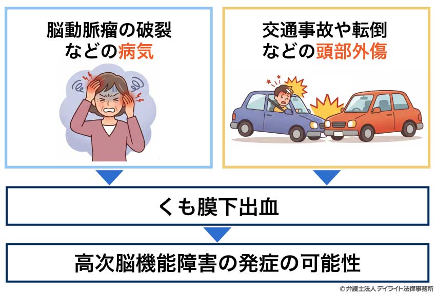 くも膜下出血を引き起こす背景