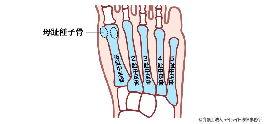 中足骨（ちゅうそくこつ）