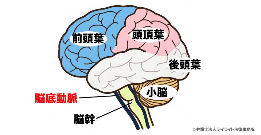 脳底動脈