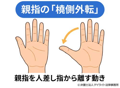 親指の「橈側外転」