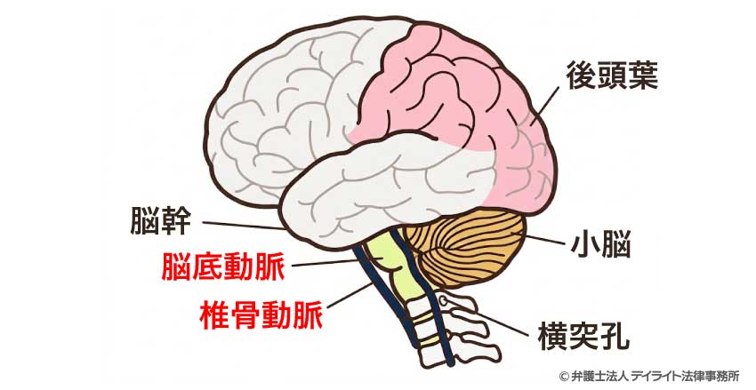 椎骨脳底動脈