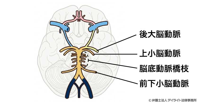 脳底動脈