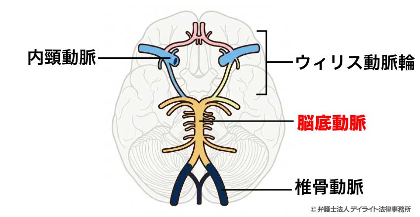 脳底動脈