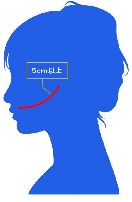 9級16号に該当する外貌醜状