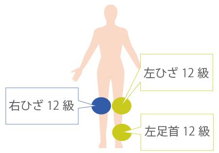 後遺障害等級の認定