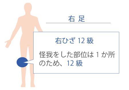 後遺障害等級の認定