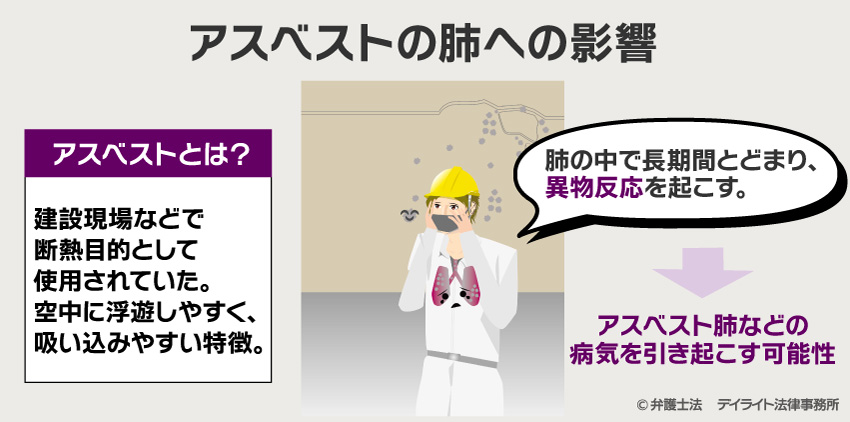 アスベストの肺への影響