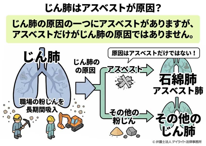 じん肺はアスベストが原因?