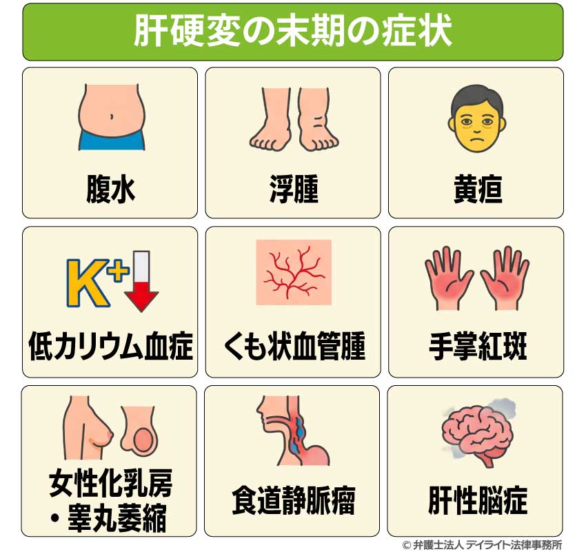 肝硬変の末期の症状