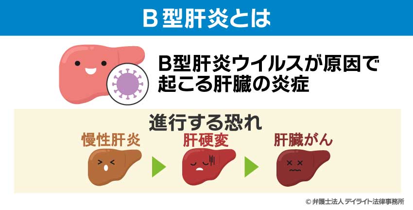 B型肝炎とは