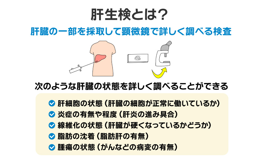 肝生検とは