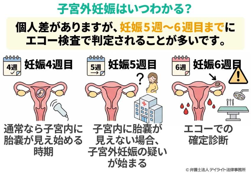 子宮外妊娠はいつわかる？